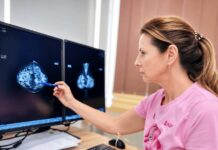 🎀 Bezplatná mamografia už aj pre ženy od 40 rokov. Nepodceňujte prevenciu.
